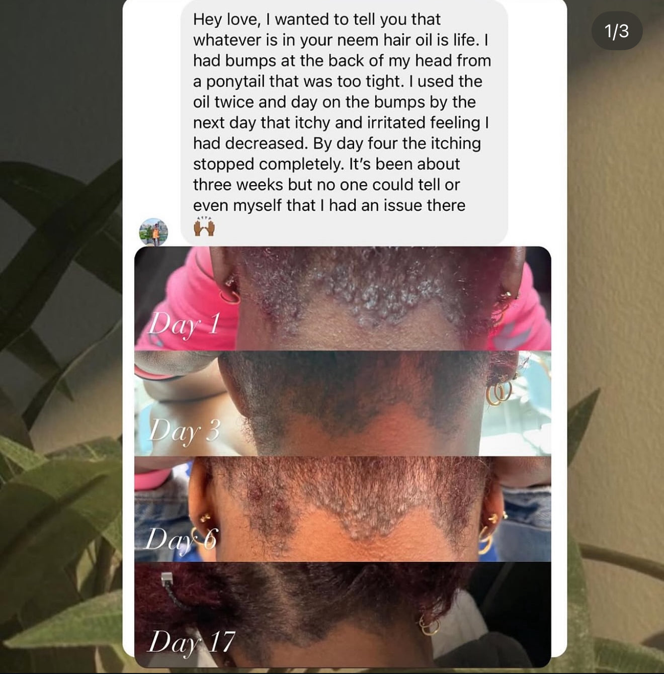 Before and after alopecia hair growth results using organic Rosemary Neem Oil showing scalp repair, hair regrowth, strengthened strands, and thinning hair recovery.